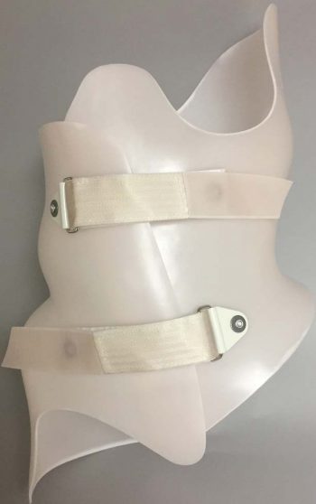 Boston Brace RC (Rigo-Cheneau) Scoliosis Brace